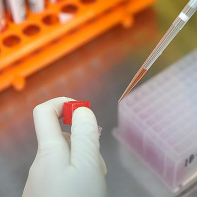 ชุดทดสอบ RT PCR Monkeypox Virus MPXV CE Registered 1 ชุดทดสอบ/ กล่อง