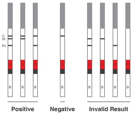 การทดสอบแอนติเจน Malaria PF PV โดยน้ำยาทดสอบ Colloidal Gold IVD